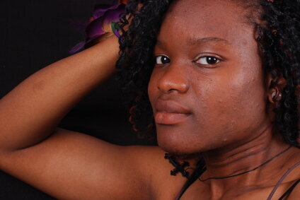 Ingredientes naturais para combater a acne